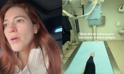 Apresentadora e ex-participante do BBB divulga novidades após acidente em viagem.